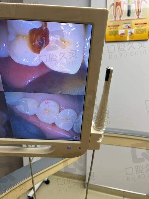 五、总结