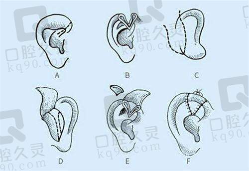 一、台州椒江韩美医疗美容门诊部怎么样？