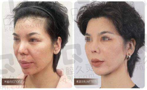 四、台州黄岩花漾医疗美容门诊部基本信息：