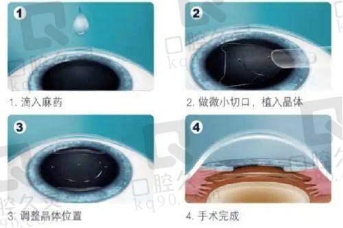 泰州张勤眼科医院价目表来啦,想了解近视矫正、白内障治疗等项目费用一看便知!