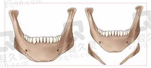 李亚飞医生的口碑评价