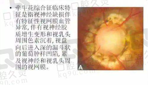 北京大学深圳医院眼科医生团队优势