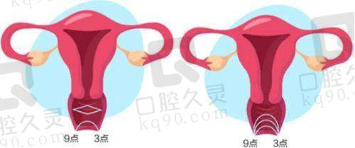 广州建国医院阴道紧缩术的手术过程是怎样的？