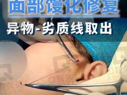 修复过程和神奇成效