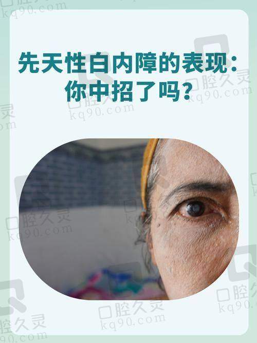 临汾洛基眼科医院白内障治疗的技术特点