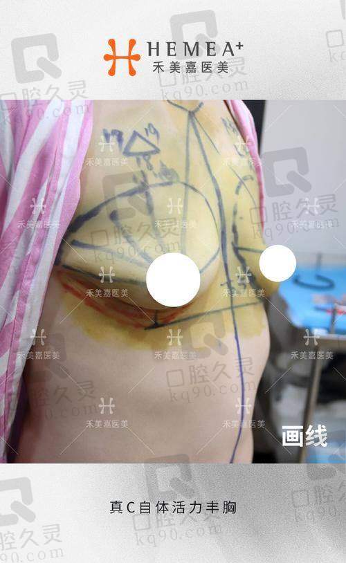 术前准备有哪些？紧张又期待
