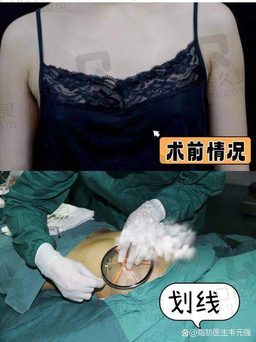 术后修复情况如何？艰辛与惊喜并存