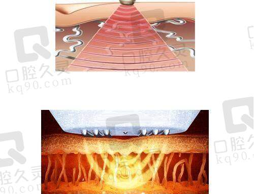 程开祥教授还能在九院做背神经修复等手术吗？上海九院程开祥技术、口碑及预约攻略揭秘