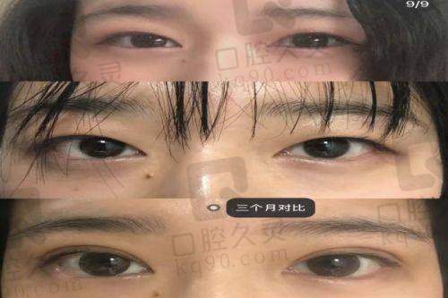 广州丽合医疗美容医院戚昌栋个人资料简介，眼整形金刀奖培训讲师技术口碑都是顶配