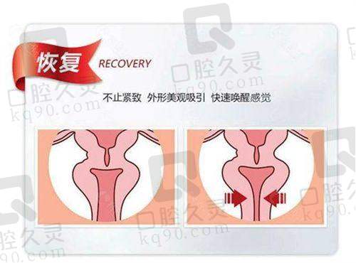 广西爱思特在医疗安心方面有保护吗？