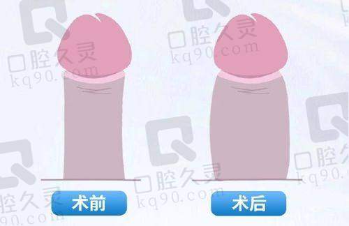 合肥华美整形外科医院官赳驹医生预约方式