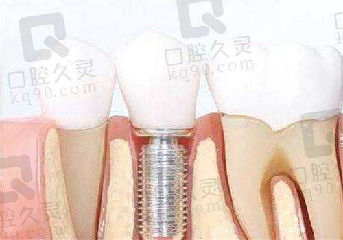 为什么说“东莞长安莞口口腔”是正规机构?证件信息给你嗷嗷亮出来