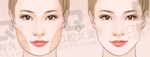 修复历程中的注意事项