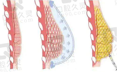 五、西安大爱医院医美科实例
