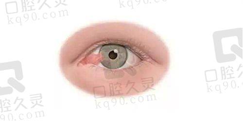 宁夏医科大学总医院眼科怎么样？公立三甲实力强，项目全设备优价格透明 