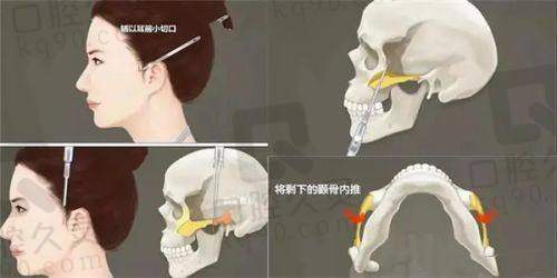 西安俪时代整形医院的口碑怎么样？