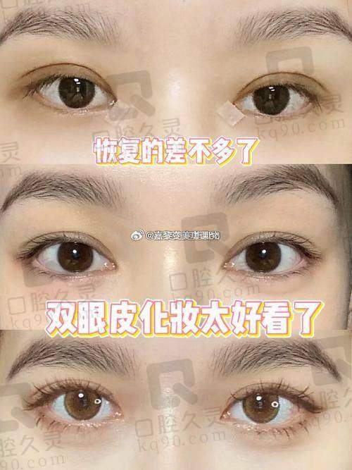 广州丽合医疗美容医院戚昌栋收费贵吗？多项目价格明细、技术优势及判断攻略揭秘