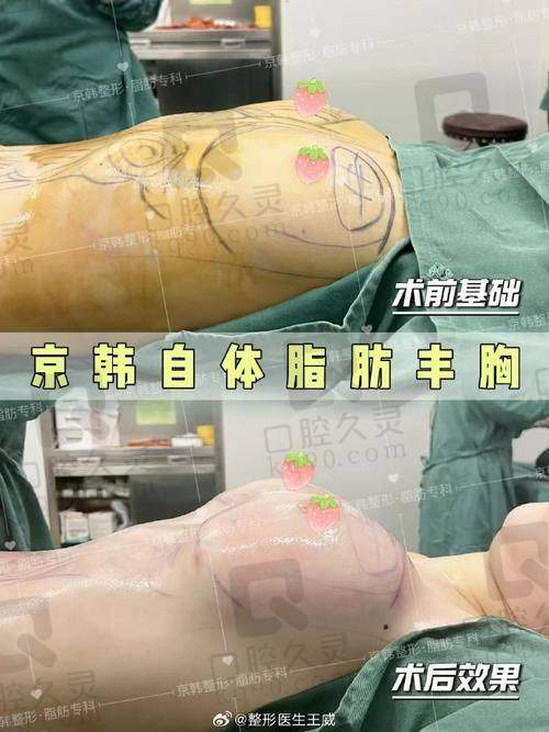 7. 苏州卫康整形医院 - 技术转型的前列