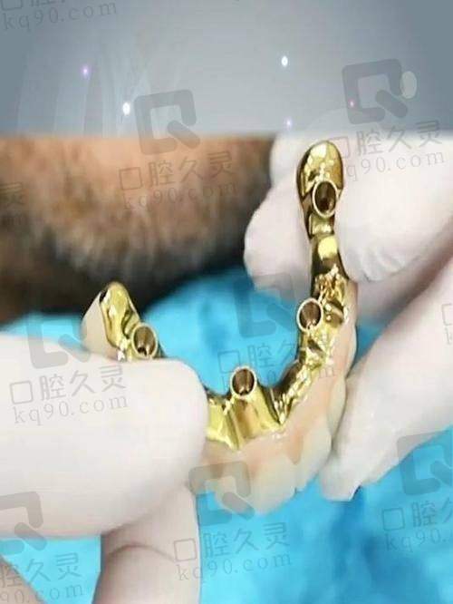 八、上海永华口腔医院适合哪些人？20-65岁看牙人群精细匹配，这3类人“闭眼冲”