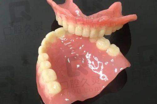 体验常州佧瓦口腔吸附性义齿，稳固贴合宛如真牙，咀嚼享受直线提升！ 