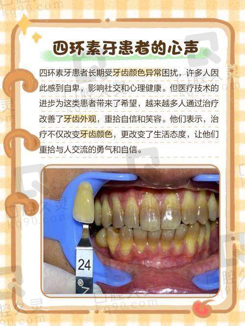 上海西郊众植口腔可以用医保吗【2025医保政策】：假牙/补牙/拔牙可报！全口活动假牙2500元起