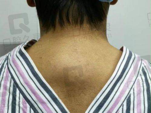 总结