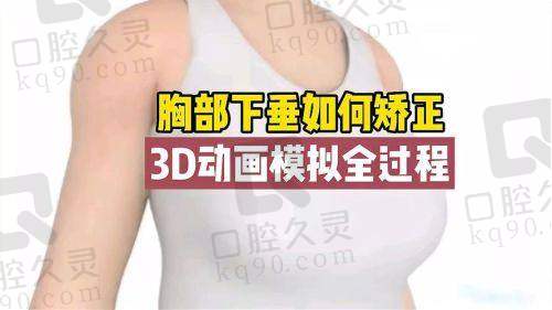 武汉做的乳房提升要多少钱？乳房下垂程度不同，价格差多少？