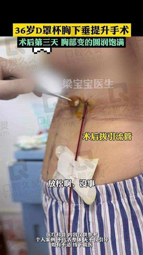武汉做的乳房提升要多少钱？公办医院 vs 私立医院怎么选？