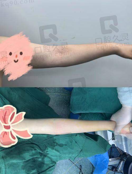 北京润美玉之光（脂肪专科）口碑好体现在服务上吗？