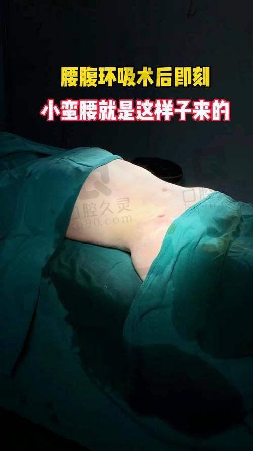 北京润美玉之光（脂肪专科）口碑好是因为医生团队吗？