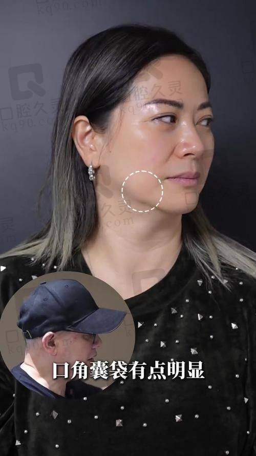 眭云鹏怎么预约？