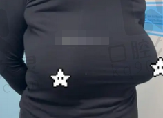 成都八大处整形巨乳缩小体验分享，术后告别负担，身姿轻盈自信感直线up！ 