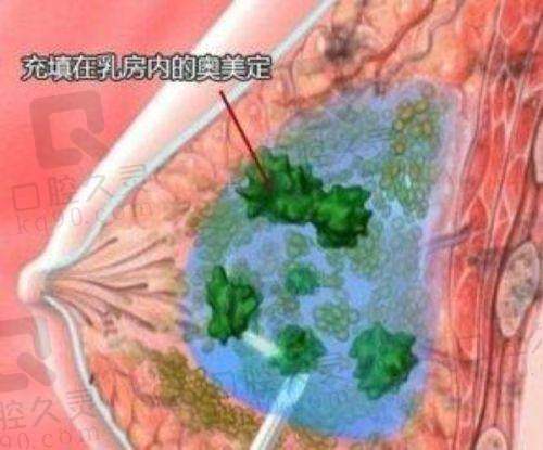 二、余东文医生详解