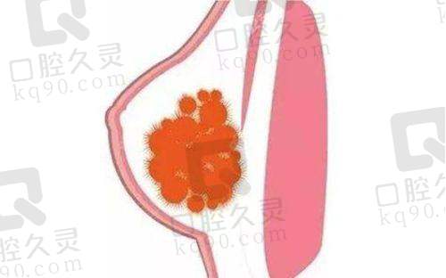 三、齐云香医生详解