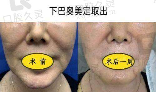 五、如何选择适合自己的医生