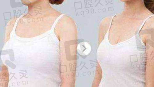 成都八大处整形巨乳缩小技术有什么特色？