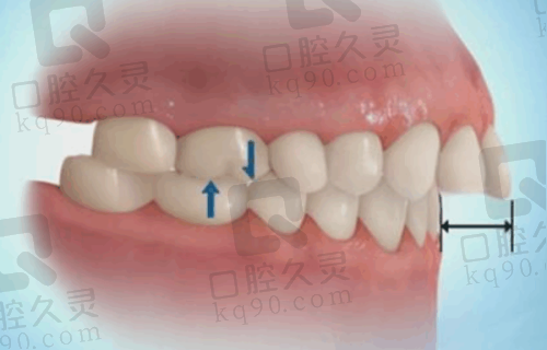 广州牙德堡口腔门诊部与其他口腔机构收费对比