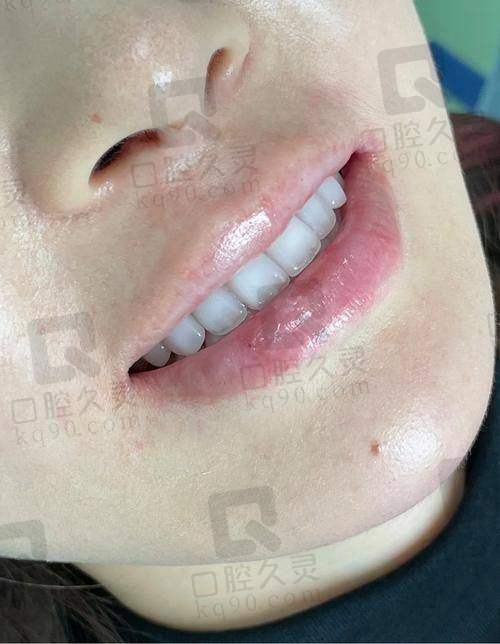 诊疗成效如何？