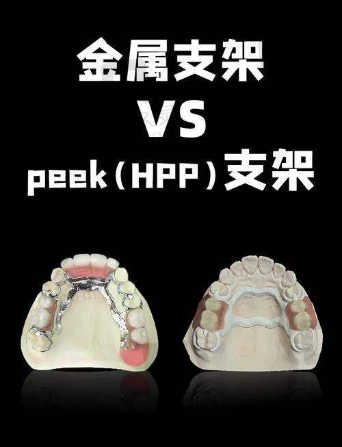 四、小结：定制属于你的一口“新牙”，从选对医院开始