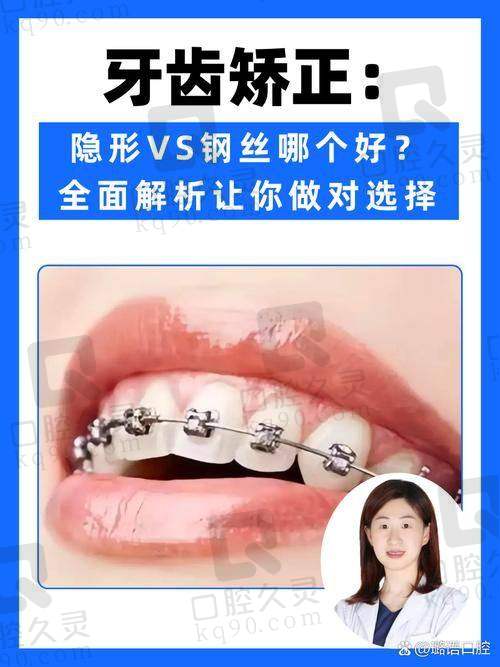 总结：丽水亮贝美口腔医院牙齿隐形矫正之旅