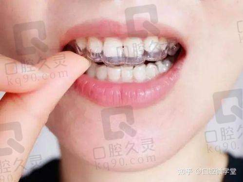 整个矫正过程的花费值得吗？