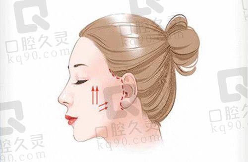 深圳美莱整形价格表更新来看看，双眼皮、隆鼻、吸脂等项目新价格全揭秘！