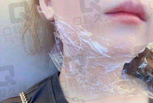广州海峡闫爱跃医生怎么样？精湛医术、丰富经验助力众多患者实现美丽蜕变 