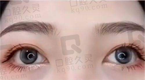 广州海峡医学整形美容医院营业时间是啥时候?周一至周日9点到20点可做多样医美项目