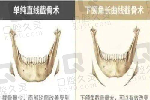 深圳婳美属于中高端档次，排名靠前技术强，多元项目与优惠兼具 