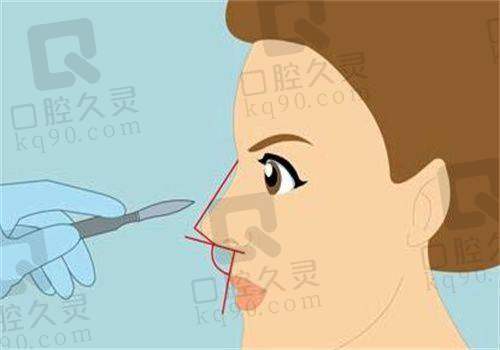 保定珍润医疗美容技术怎么样？31年老牌机构眼鼻整形优势尽显
