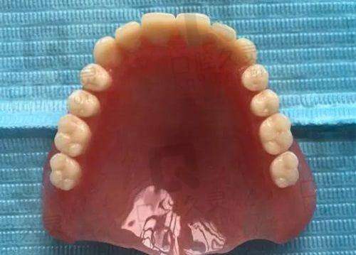 五、患者眼中的中诺口腔:真实实例说话