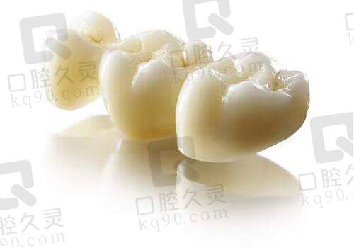 为什么选择雅安优诺口腔医院进行牙齿美白？