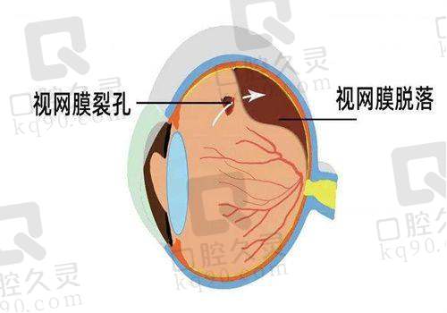 斜视矫正手术项目收费标准