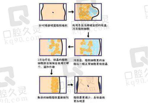 预约南宁华美整形美容医院李湘原医生需要注意什么？